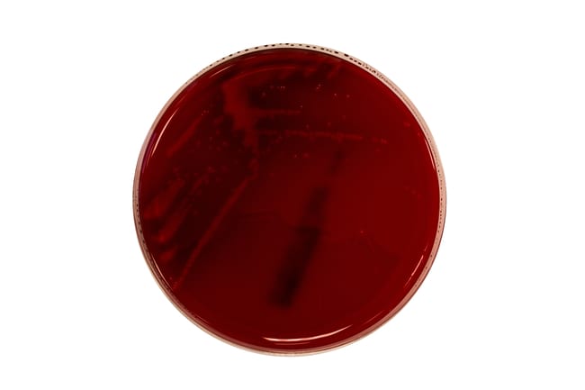 Gardnerella vaginalis Selektives Medium,